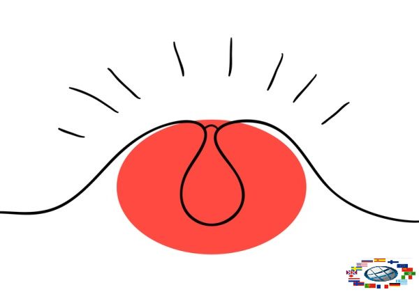 Гнойничковые заболевания пиодерматозы Гнойничковые заболевания пиодерматозы