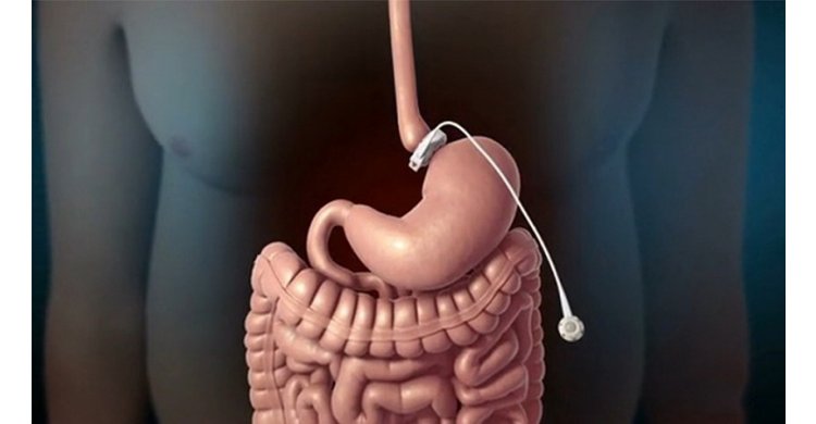 �������������� ��������