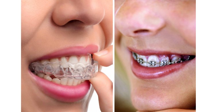 �������� vs. �������