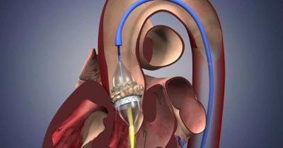 �������������� � ������ ����������� �������: ��� ����� �����?