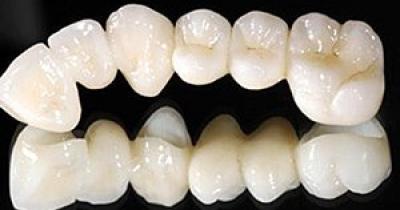 ������������ ����������� �������