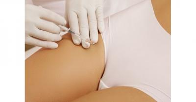 �������� �������������