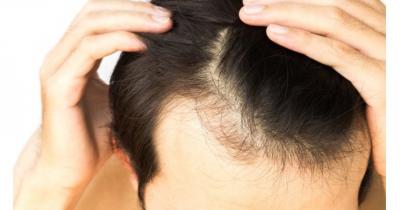 ��������� �����