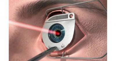 лазерная хирургия глаза