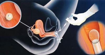 �������������� �����������: ���� � �����������