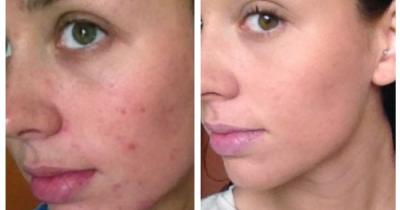 ���� ���������� �� RF-������� ����