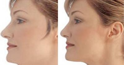 �� �������� ��� �� ��