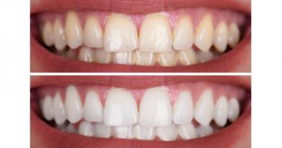 ����������� �����