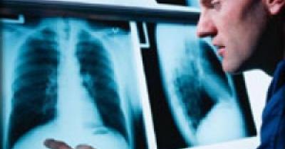 Cancer: Mesothelioma.