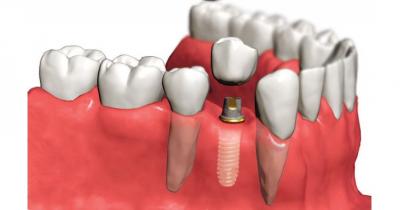 ������ �����������