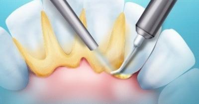 �������� ������� ����� ������������ � ������ � ���������