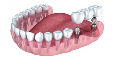 ����������� ��� ��������������