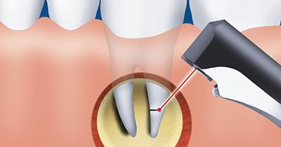 ���������� ����� ����