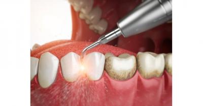 ������ air flow